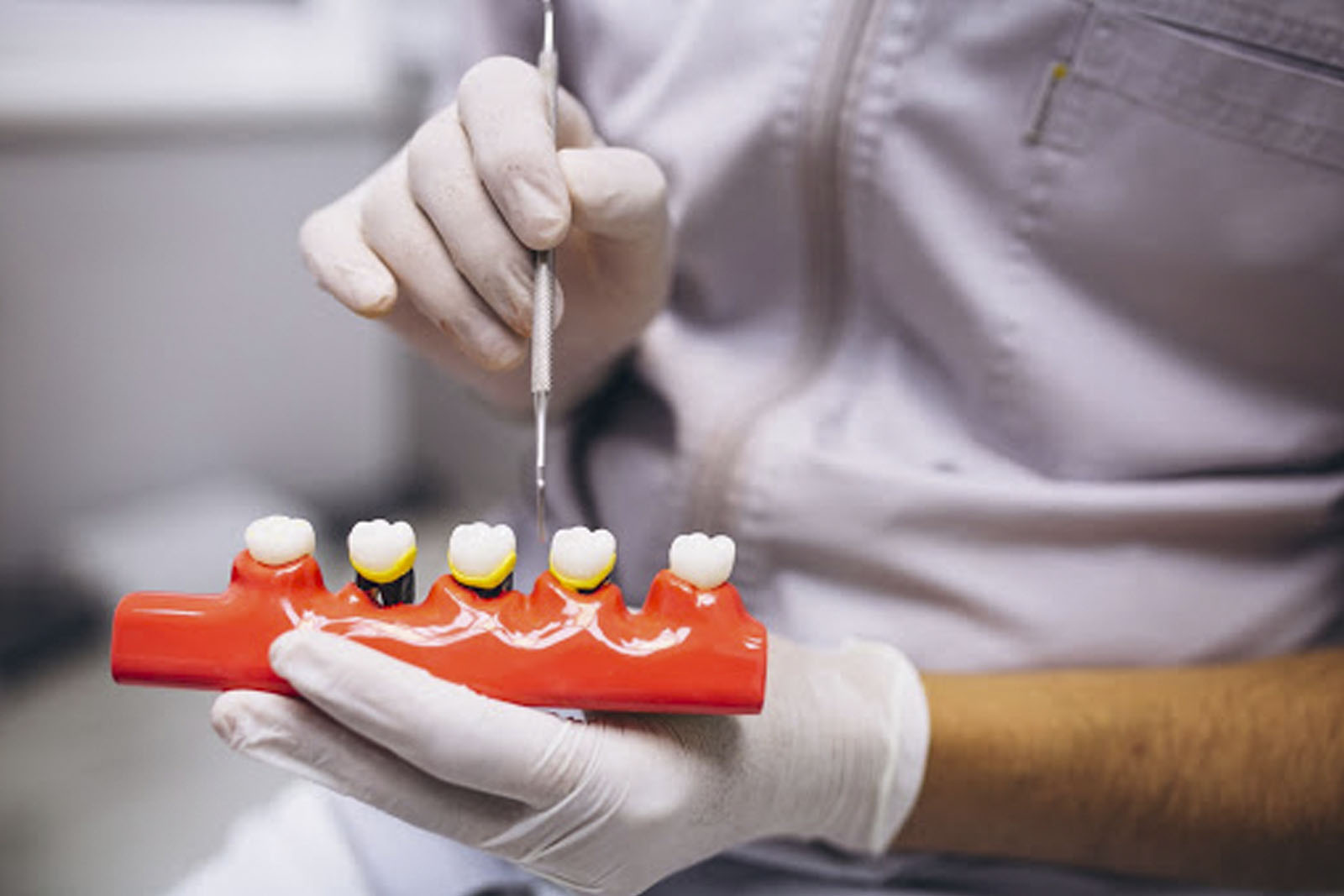 endodoncia